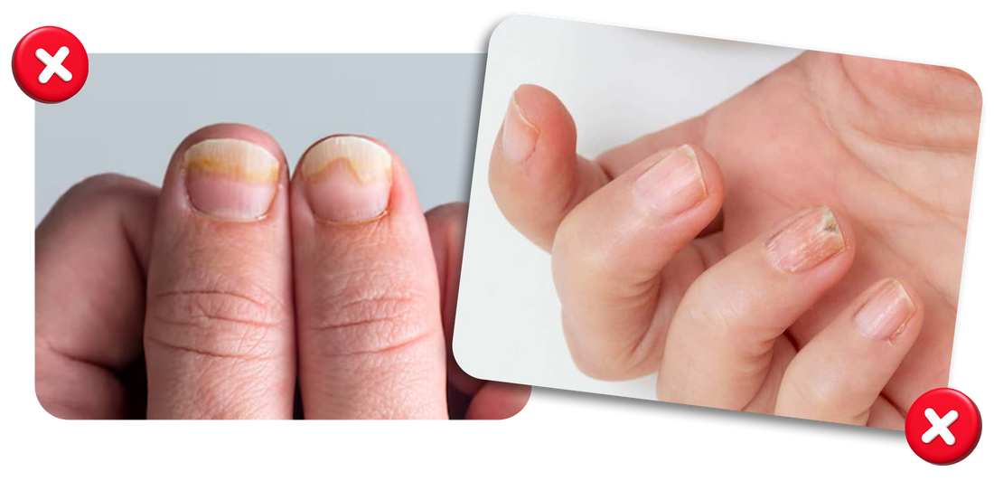 El error común de “sacar lo feo” sin tratar la raíz del problema