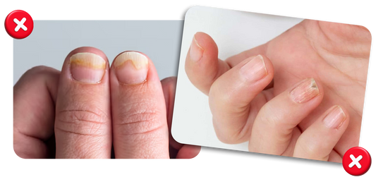 El error común de “sacar lo feo” sin tratar la raíz del problema