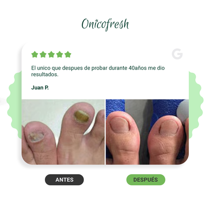 Onicofresh® Fitospray para Uñas, Manos y Pies 75ml