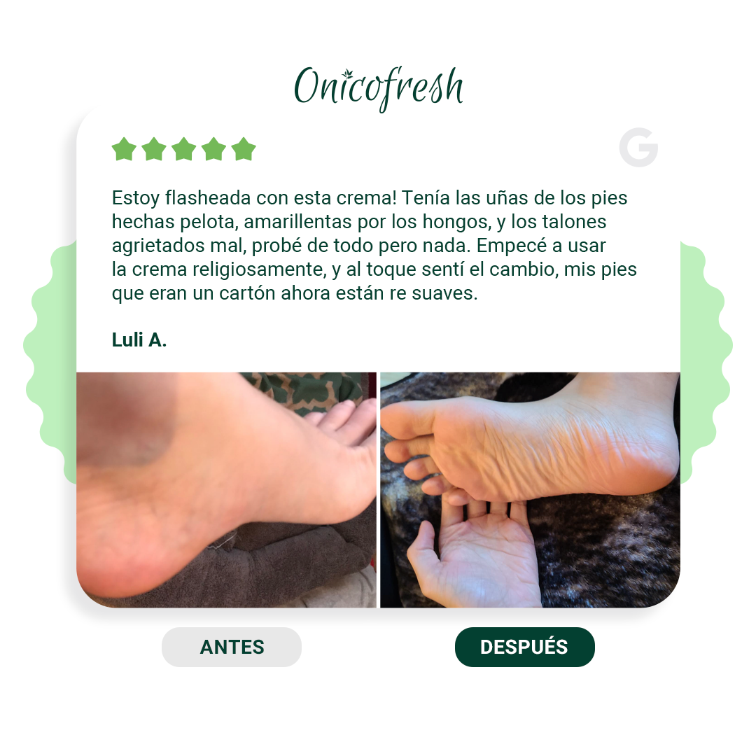 Onicofresh® KIT para Uñas, Manos y Pies: 2 Fitospray + 1 Crema 75 ml c/u