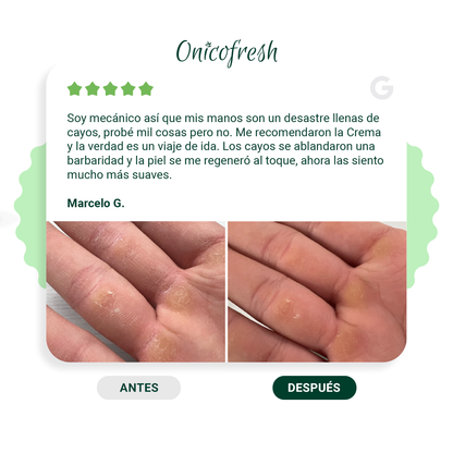 Kit Antihongos Manos, pies, cuerpo y zonas sensibles: 2 Cremas 75 ml c/u